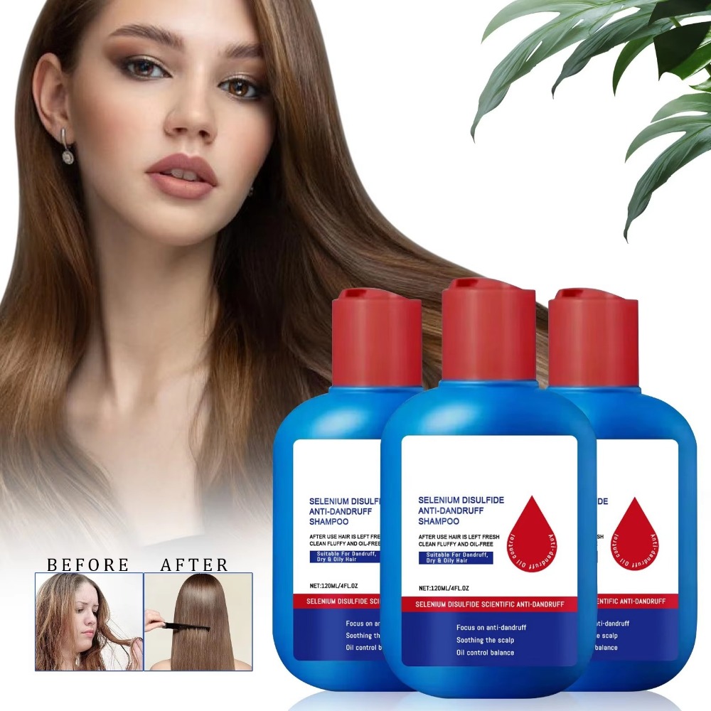 Hair Care Dandruff - Nieuwe 120ml Nipori Shampoo Oil Control