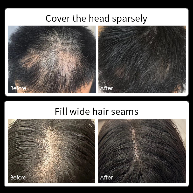 Ginzo Scalp Concealer Haarverf - Hair Care Lotion recensie en prijs