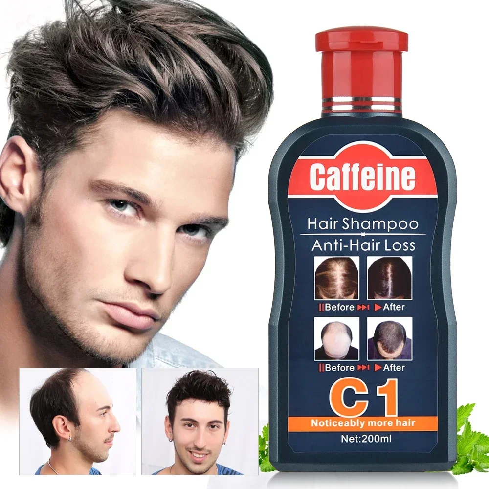 Mannen Shampoo Voor Haargroei  - Hair Care Korean Products recensie en prijs